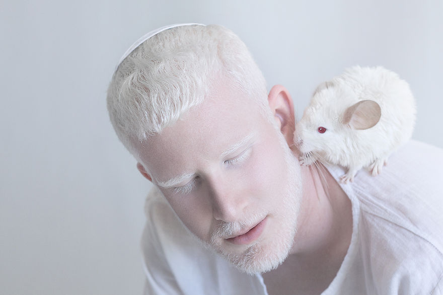 albinos_07
