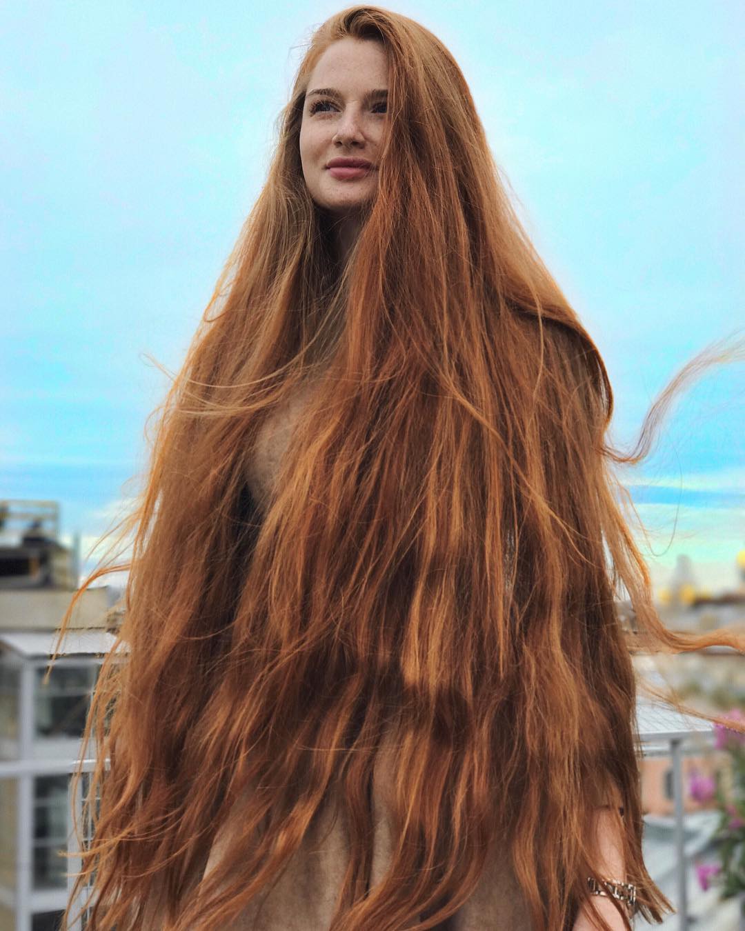 Девушка которая страдала от алопеции, смогла победить болезнь и отрастить красивые длинные волосы